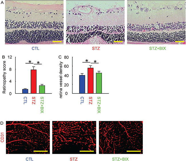 BIX attenuates DR in STZ-mice.