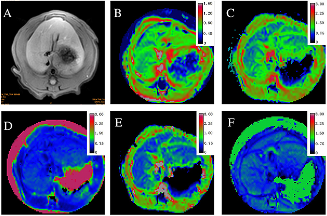 Axial MR images in sequence from a stage F2 fibrosis induced by carbon tetrachloride (CCl4).