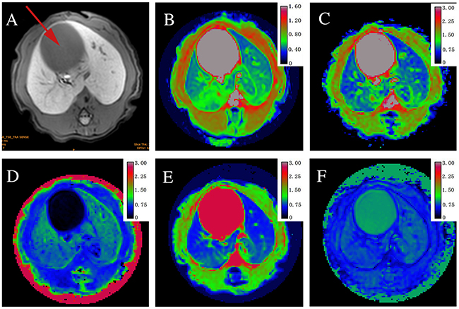 Axial MR images in sequence from a stage F2 fibrosis induced by biliary duct ligation (BDL).