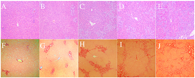 Typical hematoxylin and eosin (H&E) staining and picrosirius red staining for representative samples in the biliary duct ligation (BDL) group.