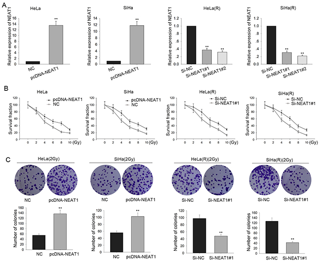 Enhanced NEAT1 strengthens the radio-resistance in cervical cancer cells.