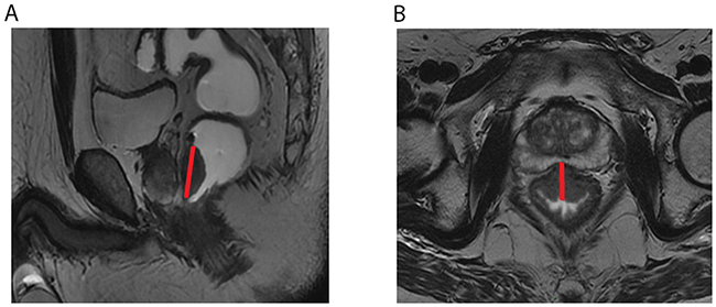 Figure 3: