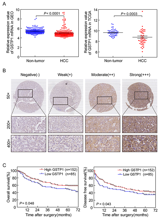 GSTP1 expression in HCC correlated with longer OS and DFS.