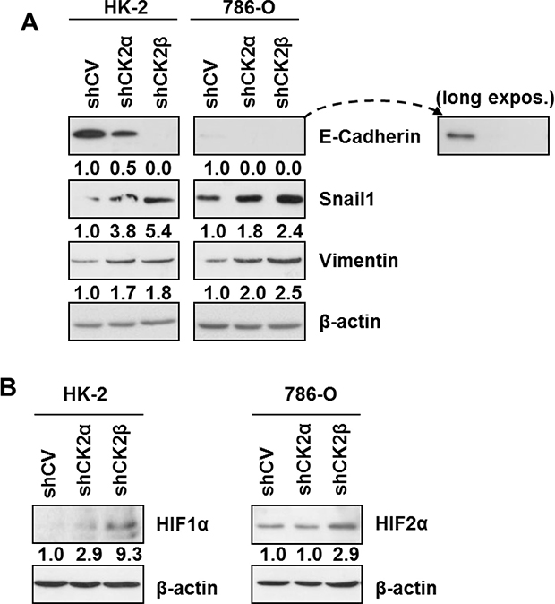 Expression of EMT markers and HIF