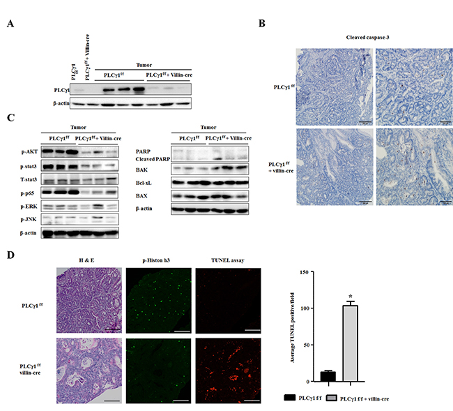 In the AOM/DSS model, deletion of PLC&#x03B3;1 in IECs decreases tumor incidence by increasing apoptosis and inhibiting proliferation.