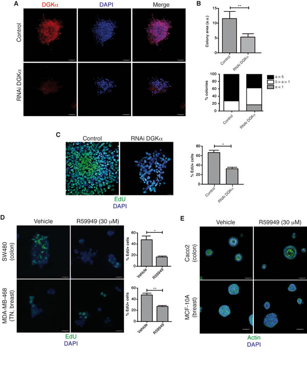 DGK&#x3b1; is necessary for cancer cell growth in 3D conditions.