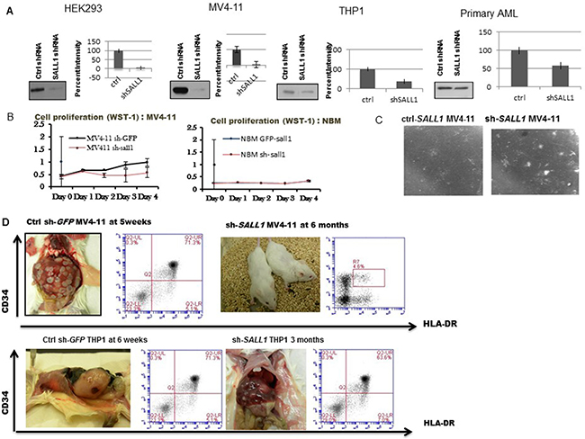 SALL1 Inhibition is associated with decreased cellular proliferation, improved GM-CFUs formation and inferior AML engraftment in NSG mice.