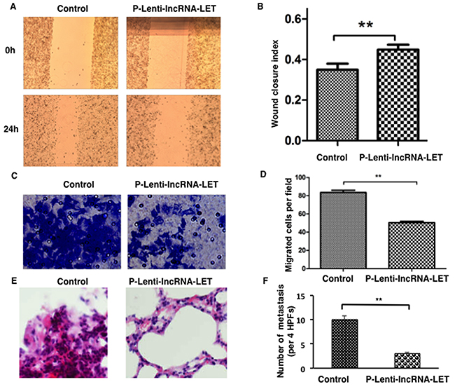 Overexpression of lncRNA-LET inhibits migration and invasion of NSCLC H292 cells both in vitro and in vivo.