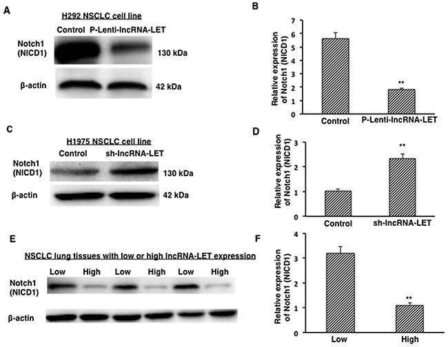 Expression of active form of Notch1 (NICD1) in NSCLC tissues and cells.
