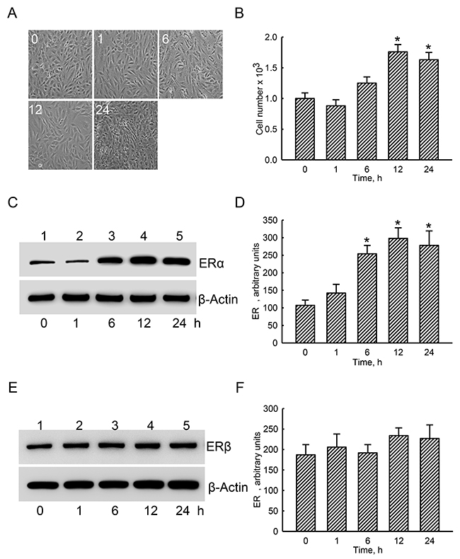Effects of estradiol on levels of estrogen receptor alpha (ER&#x03B1;) and ER&#x03B2; proteins.