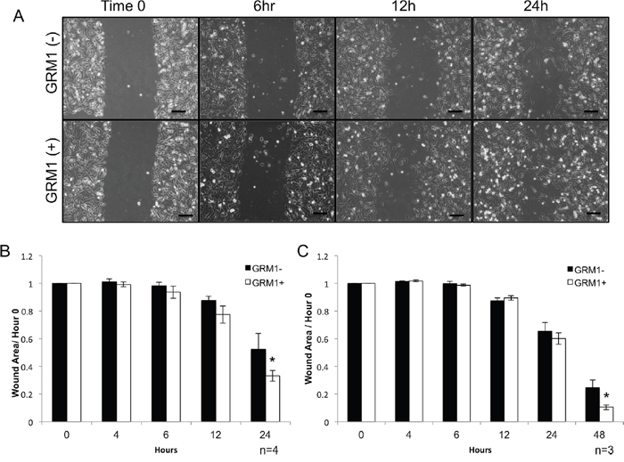 GRM1- cells exhibit increased mobility when exposed to GRM1+ cell derived exosomes.