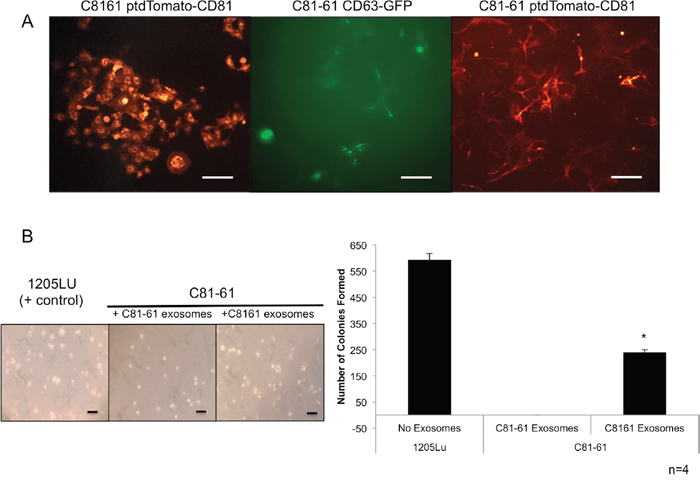 GRM1+ exosomes induce anchorage independent growth in GRM1- cells.