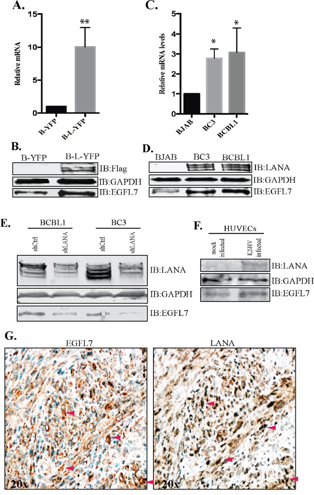 EGFL7 was upregulated in LANA expressing BJAB and KSHV infected PELs and KS-tissues.