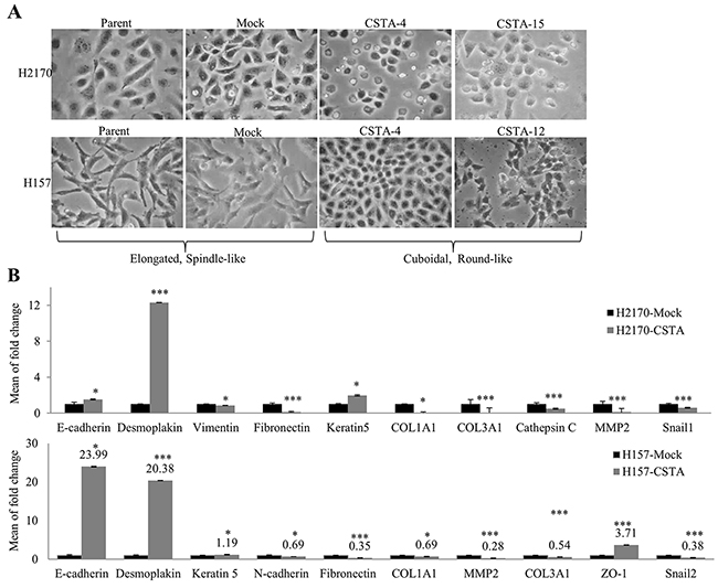 CSTA overexpression leads to an alteration in morphology and the expression of EMT markers.