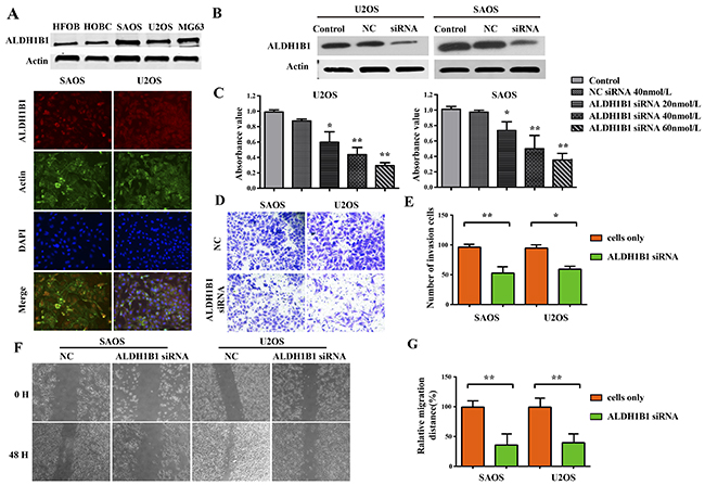 The role of ALDH1B1 in the growth and proliferation, invasion and migration of OS cells.