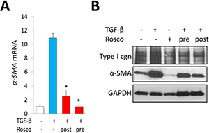 Inhibition of CDK5 abrogates TGF-&#x00DF; responses in skin organ cultures.