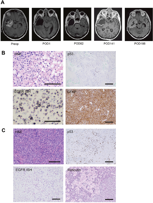 Radiographic and immunohistochemical characterization of GBM1 and SGS1.