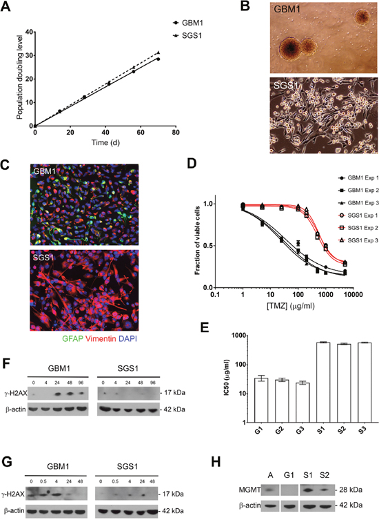 Growth rate and chemoresistance of GBM1 and SGS1 gliomaspheres.