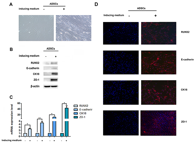 Expression of RUNX2 and E-cadherin during epithelial differentiation.