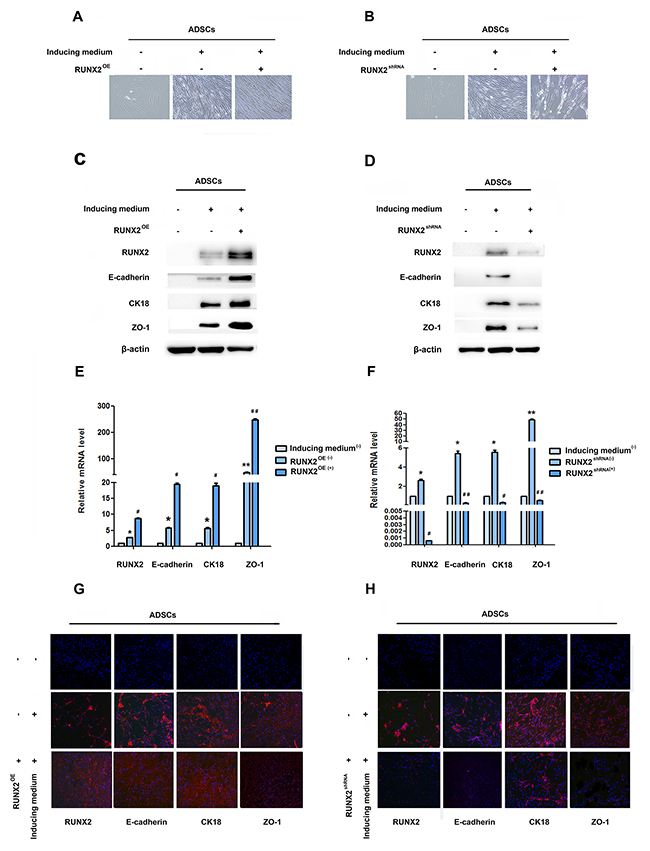 RUNX2 positively regulates E-cadherin expression and epithelial differentiation.