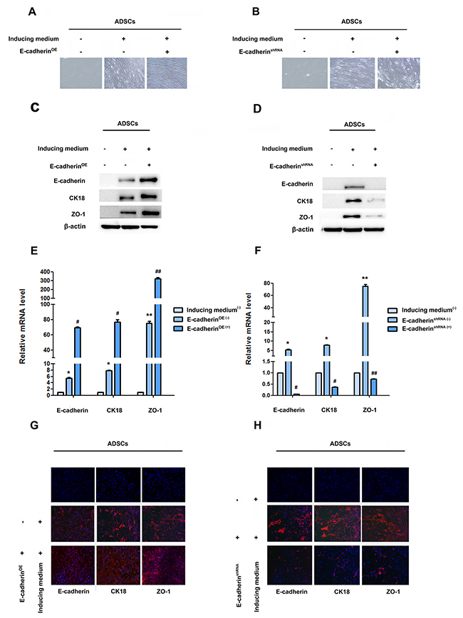 E-cadherin facilitate epithelial differentiation.