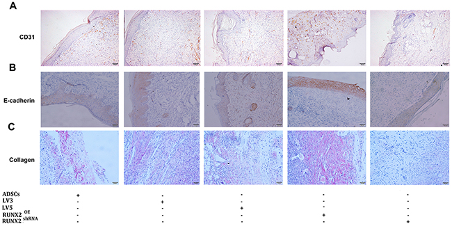 RUNX2 improves neovascularization and re-epithelialization of burn skin of mice.