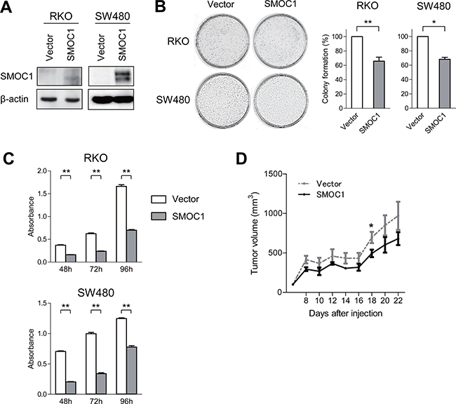 Functional analysis of SMOC1 in CRC cells.