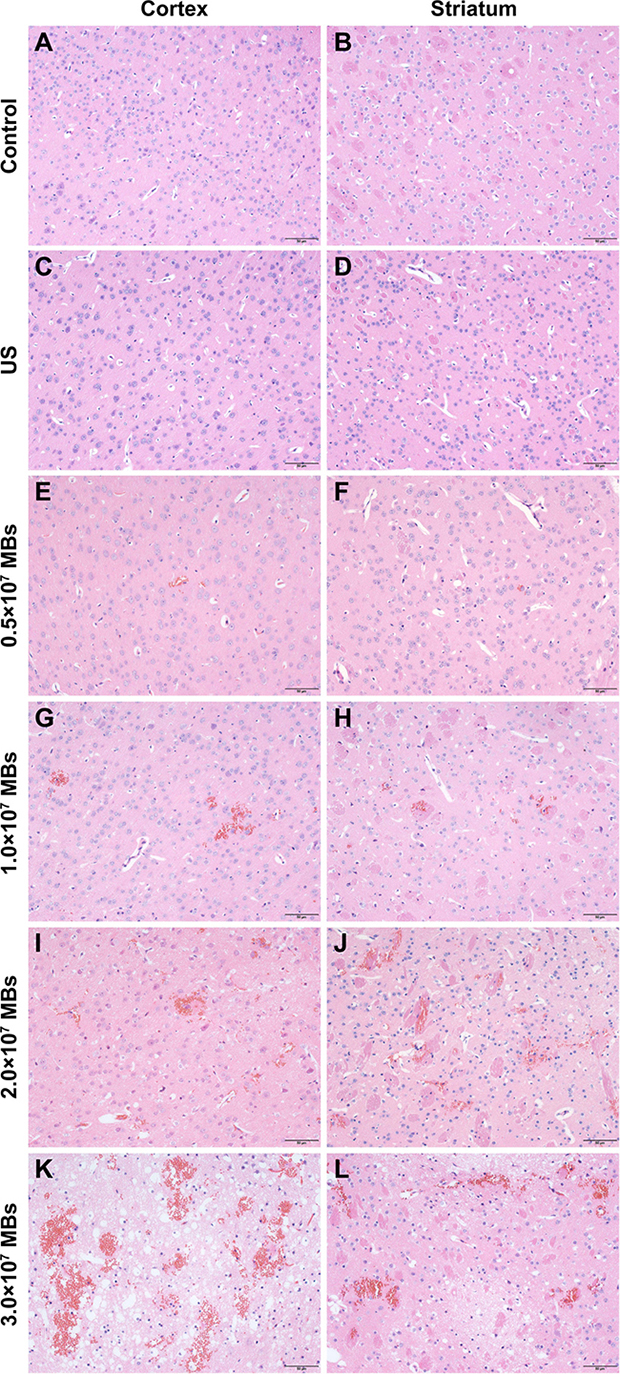 Representative coronal hematoxylin and eosin (H&#x0026;E) stained sections of the cortex and striatum obtained at different MB doses.