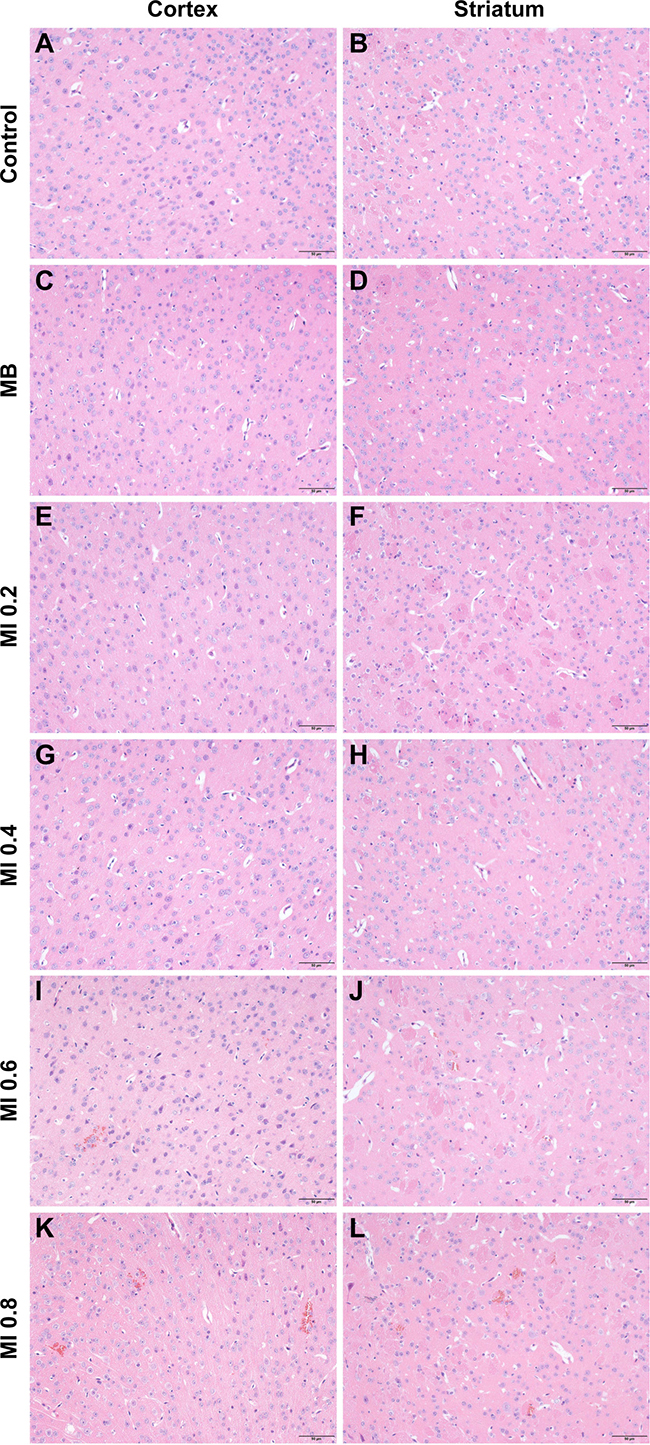 Representative coronal hematoxylin and eosin (H&#x0026;E) stained sections of the cortex and striatum obtained at different MIs.