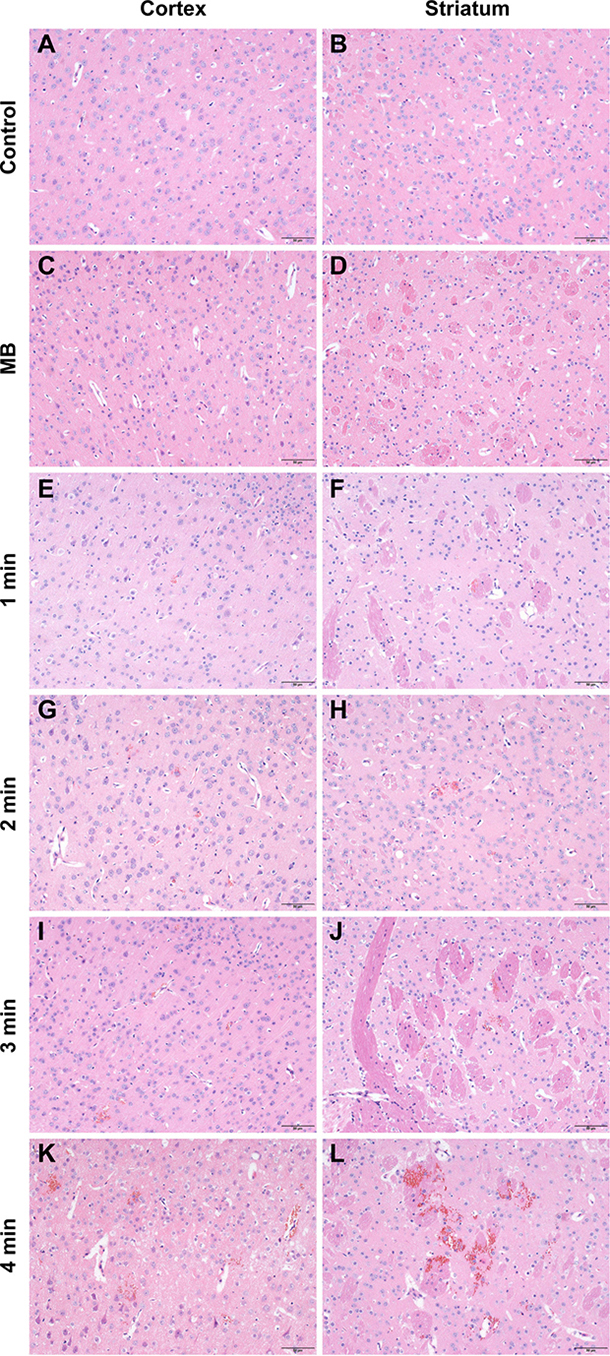 Representative coronal hematoxylin and eosin (H&#x0026;E) stained sections of the cortex and striatum of mice obtained at different sonication durations.