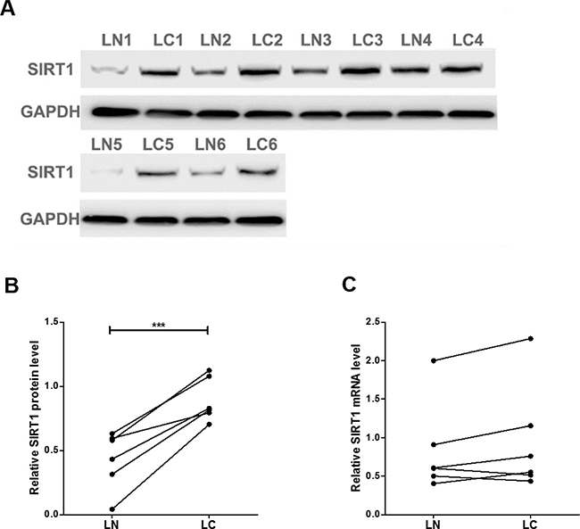 SIRT1 protein and mRNA expression levels in lung cancer tissues.