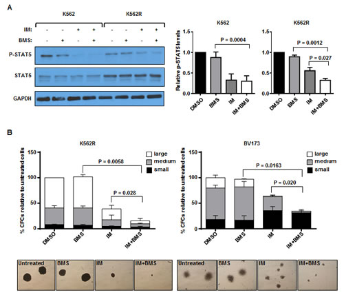 Combination treatment with BMS-911543 and imatinib (IM) is more effective at reducing pSTAT5 levels and inhibiting proliferative capacity of IM-resistant K562 and BV173 cells.