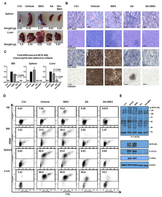 Effects of oral treatment of BMS-911543 in combination with DA on the infiltration of leukemic cells into hematopoietic tissues of mice.