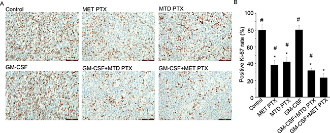 Ki-67 expression in transplanted tumors from different groups.