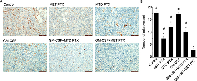 MVD in transplanted tumors from different groups was determined by immunofluorescence staining using an anti-CD31 antibody.