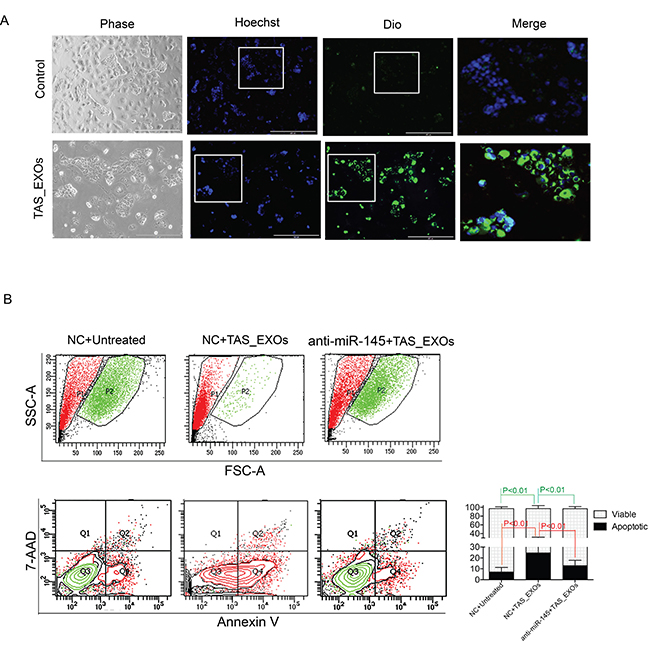 Exosomes derived from TAS cells induced PDAC cell death is mitigated by a miR-145 inhibitor.