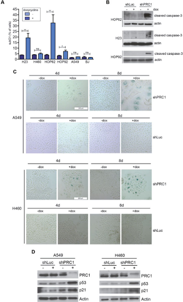 Depletion of PRC1 results in apoptosis in p53-mutant lung cancer cell lines and in senescence in A549 cells with p53 wildtype status.