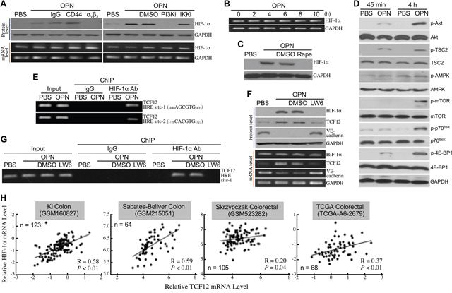 HIF-1&#x03B1; is involved in OPN-induced TCF12 expression.
