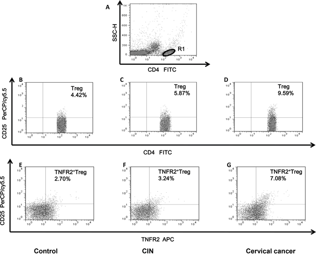 Dot plots of circulating Tregs and TNFR2+Tregs in representative patients with CIN, CC and healthy controls.