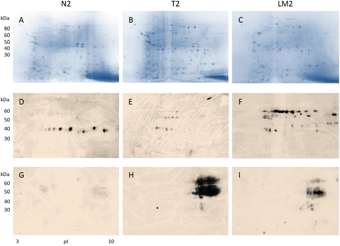 Detection of antibody-reactive proteins in tissue extracts from a female patient with stage IV colon cancer and liver metastasis.