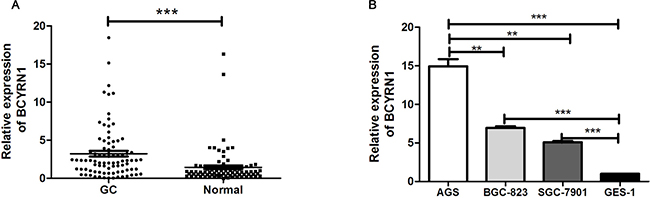 BCYRN1 expression in primary GC tissues and cell lines.