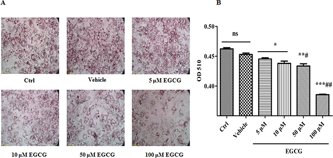 EGCG inhibits the lipid accumulations during adipogenesis.