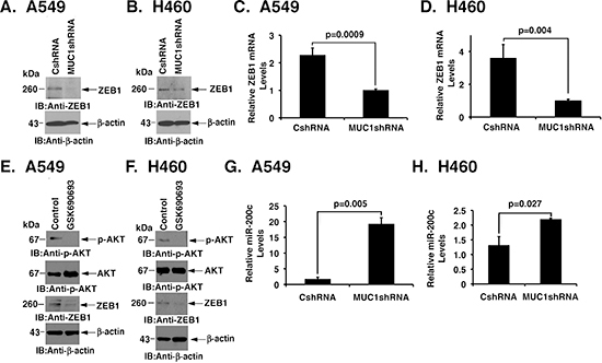 Silencing MUC1-C confers the coordinate downregulation of ZEB1 and induction of miR-200c expression.