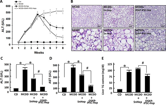 Transplantation of OSKP-iPSC-Heps alleviated steatohepatitis in 18-month-old male MCD diet-fed mouse.