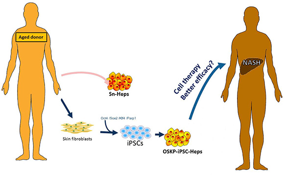 Scheme for the generation of OSKP-iPSC-Heps from aged donor-derived somatic cells.