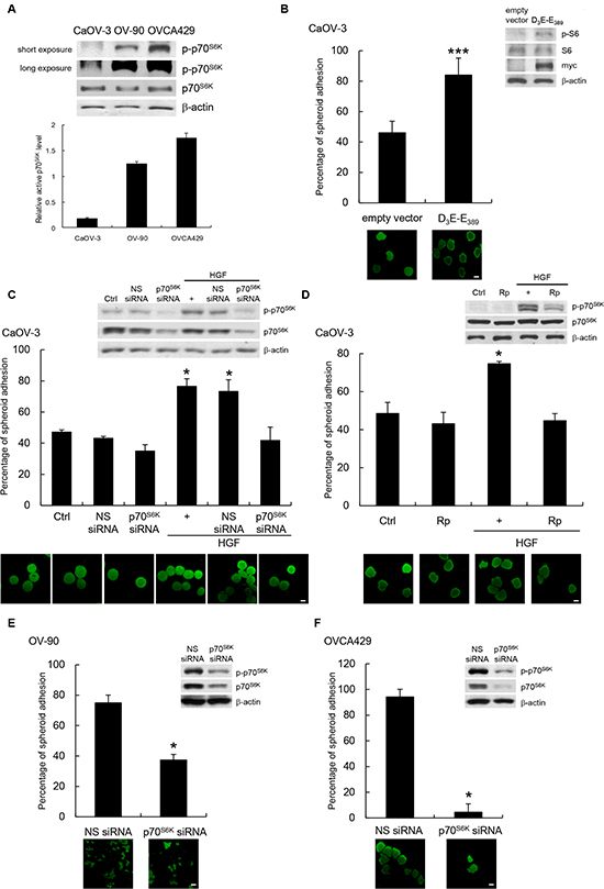 p70S6K activation promotes cancer spheroid adhesion to human peritoneal mesothelial cells.