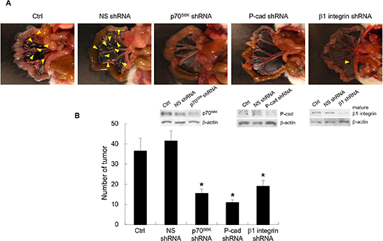 Inhibition of p70S6K-P-cadherin-&#x03B2;1 integrin signaling reduces peritoneal metastasis in vivo.