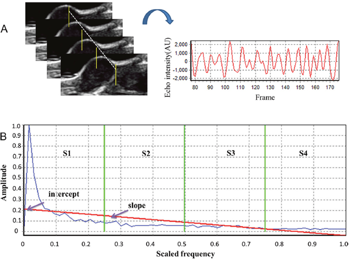 Analysis of ultrasonic RF time series features.