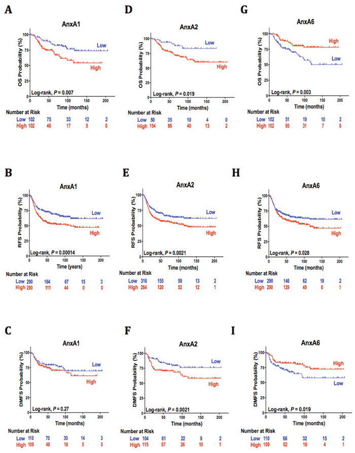 AnxA1, AnxA2, and AnxA6 independent association with clinical outcomes.