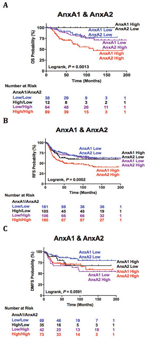 AnxA1 and AnxA2 dual association with clinical outcomes.